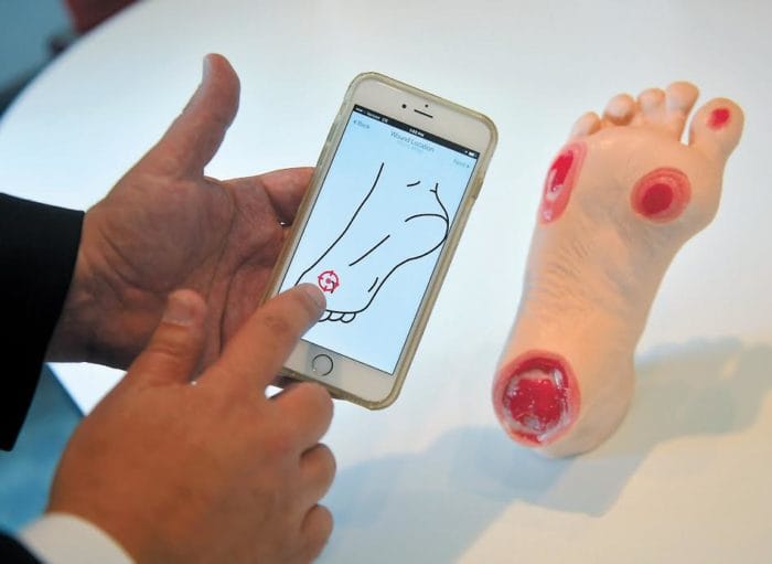 Less Than 1 Percent of Nurses Are Wound Experts. This Telehealth App Helps Close That Gap